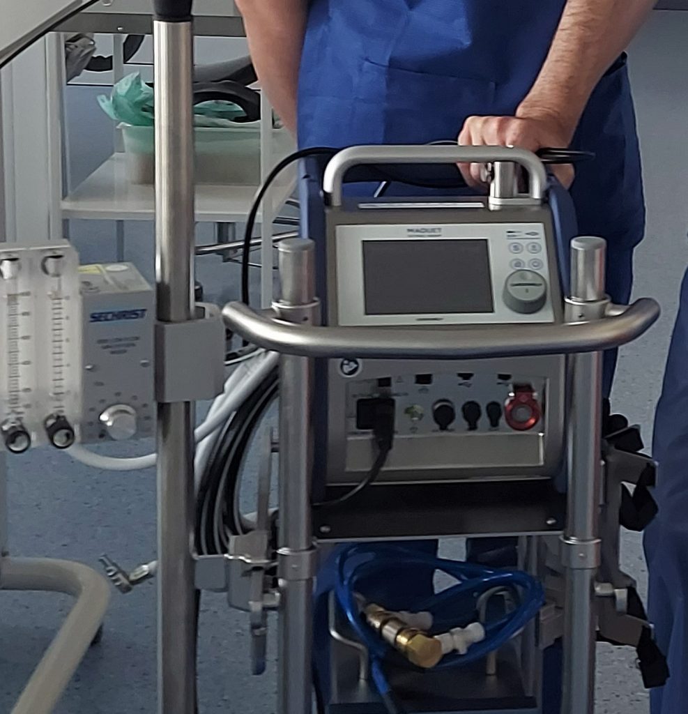 pristroj ECMO